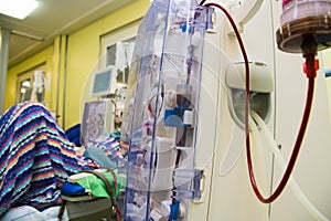 Advanced dialysis equipment in hospital