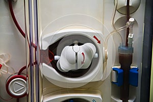 Advanced dialysis equipment in hospital