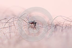 Aedes aegypti sucking blood human.