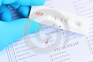AFP positive test result by using rapid test cassette photo