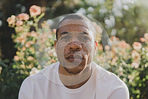 African American man with freckles outdoors looking serious