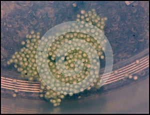 African clawed frog eggs