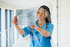 African doctor looking at patient`s x-ray at hospital