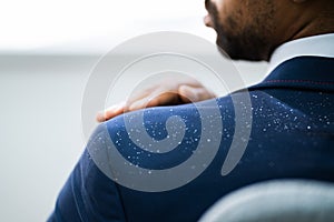 African Man Brushing Dandruff