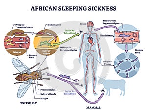 African sleeping sickness or African trypanosomiasis illustration diagram