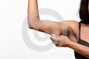 African young woman pinching her arm