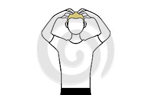 AGA Male pattern baldness man