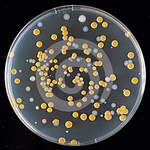Agar culture of various bacteria in a Petri dish