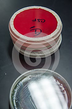 Agar plates with CSF samples