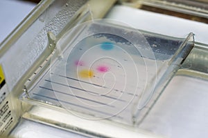 Agarose gel electrophoresis