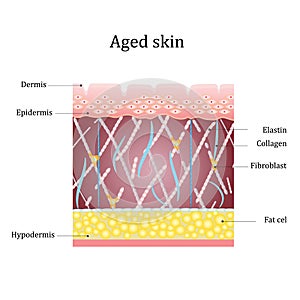 Aged skin layer. Structure human aged skin with collagen and elastin fibers, fibroblasts. Vector diagram photo