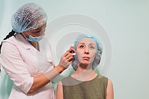 Aged woman doing mesothreads and Thread Lifting, Cosmetology. Cosmetic procedure to eliminate signs of aging. Beauty