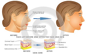 Ageing face changes