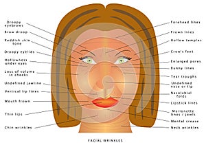 Ageing face changes