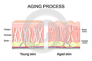 Aging process. comparison of Young and aged skin. Collagen, Elastin and fibroblasts