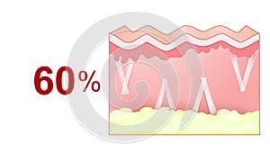 Aging process. Degradation of collagen fibers in the skin