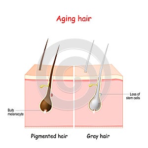 Aging process through gray hair. Pigmanted and gray hair photo
