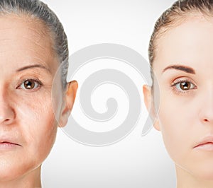 Aging process, rejuvenation anti-aging skin procedures