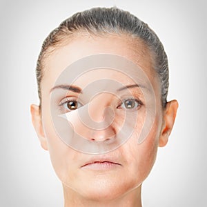 Aging process, rejuvenation anti-aging skin procedures