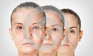 Aging process, rejuvenation anti-aging skin procedures