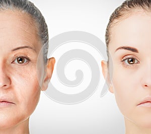 Aging process, rejuvenation anti-aging skin procedures photo