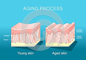 Aging process in the skin. wrinkles