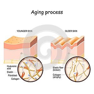 Aging process. younger and older skin.