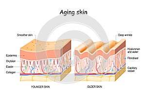 Aging skin. collagen  elastin  and Oxytalan fibers. Hyaluronic acid