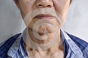 Aging skin folds or skin creases or wrinkles of Asian Chinese old man