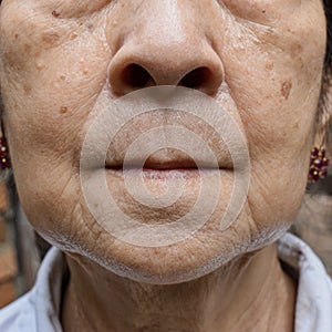 Aging skin folds or skin creases or wrinkles at face of Asian, Chinese old woman