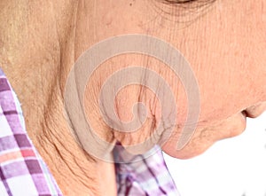 Aging skin folds or skin creases or wrinkles at neck of Asian, Chinese elderly woman