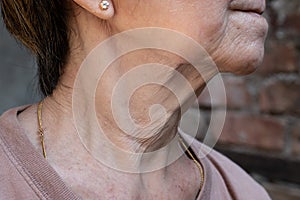 Aging skin folds or skin creases or wrinkles at neck of Asian, Chinese old woman