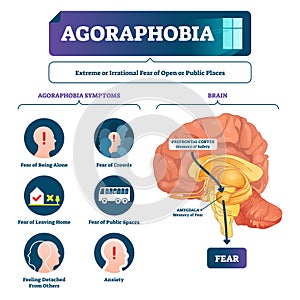 Agoraphobia vector illustration. Labeled anatomical fear explanation scheme photo