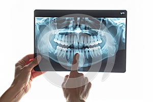 AI generated image. a dentist looking at a dental x-ray