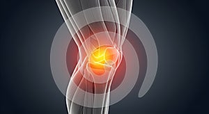 AI-Generated Knee Pain Visualization