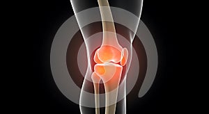 AI-Generated Knee Pain Visualization