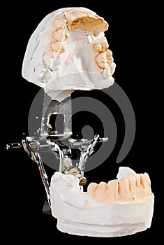 Alabaster cast jaws man