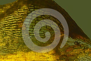 Alar cells of a branch leaf from a broom moss