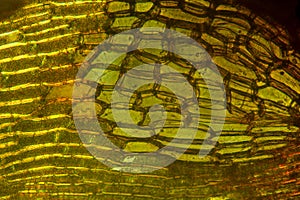 Alar cells of a branch leaf from a broom moss