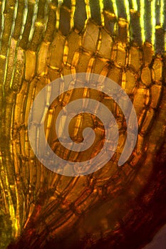 Alar cells of a branch leaf from a broom moss