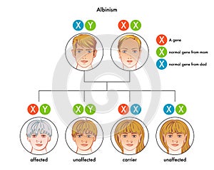 Albinism