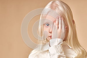 Albino. Cute little girl with albinism syndrome