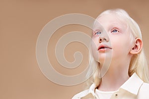 Albino. Cute little girl with albinism syndrome