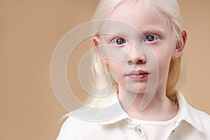 Albino kid girl with white skin and white hair isolated