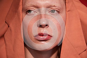 Albino male with womanlike appearance wearing orange jacket at his head