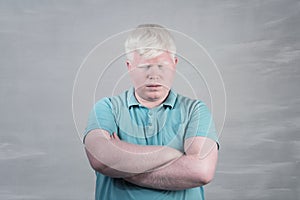 Albino young man portrait. Blond guy isolated at grey background. Albinism