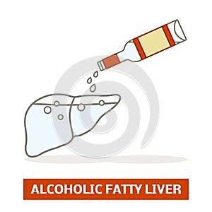 Alcoholic fatty liver
