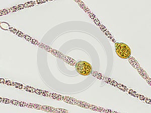 Algae under microscopic view - Akinete