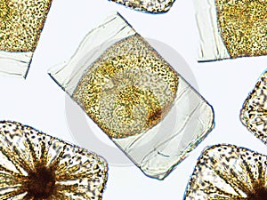 Algae under microscopic view, Chrysophyte, diatoms, phytoplankton, fossils, silica, golden yellow algae