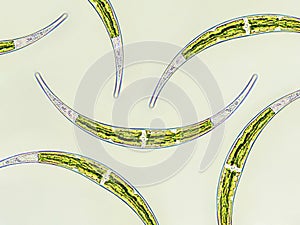 Algae under microscopic view x40, Closterium, Charophyta, Green algae, pattern background